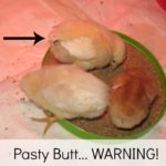 Pasty Butt WARNING!